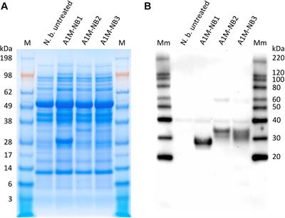 Expression, Purification and Initial Characterization of Functional α1-Microglobulin (A1M) in Nicotiana benthamiana